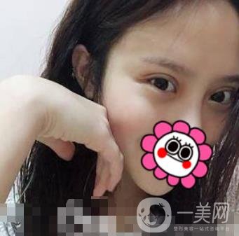 溫嶺芘麗芙整形醫(yī)院2020年價格表更新_雙眼皮整形*果實拍