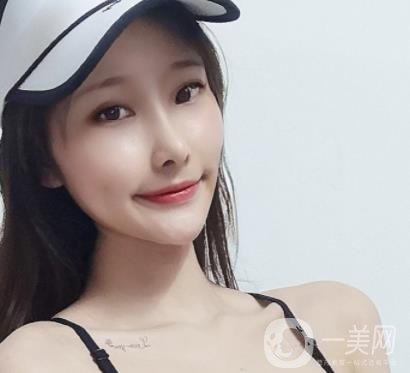 東京湘南美容醫(yī)院 瘦臉