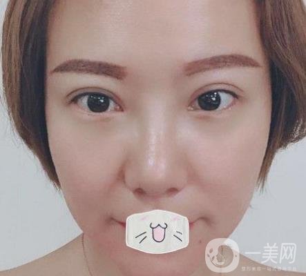 綿陽(yáng)中心醫(yī)院整形美容科價(jià)格表2020發(fā)布，附祛眼袋案例