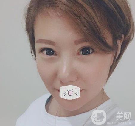 綿陽(yáng)中心醫(yī)院整形美容科價(jià)格表2020發(fā)布，附祛眼袋案例