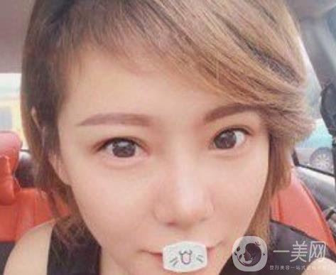 綿陽(yáng)中心醫(yī)院整形美容科價(jià)格表2020發(fā)布，附祛眼袋案例