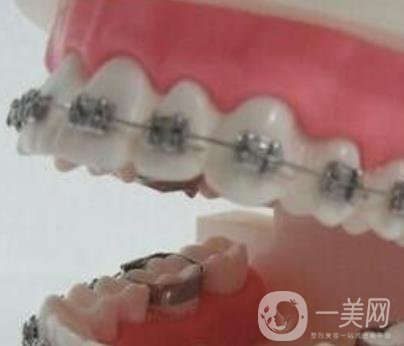 泉州人民醫(yī)院整牙