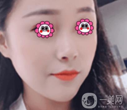 岳陽(yáng)市第一人民醫(yī)院整形美容科祛斑好嗎？?jī)r(jià)格表和案例日記分享