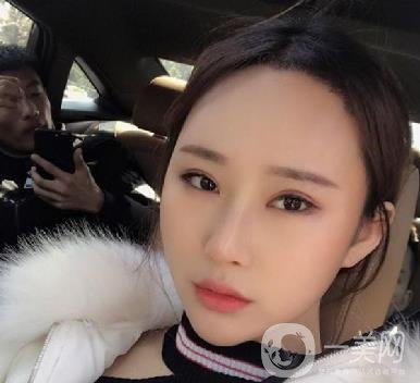 河北省中醫(yī)院整形美容科隆鼻怎么樣？價格表及術后恢復日記分享