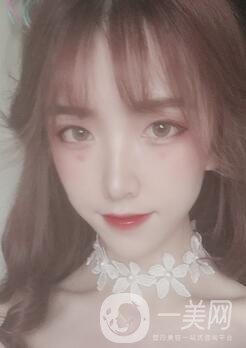 南昌二附院整形科價格表2020，附肋軟骨隆鼻整形案例