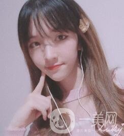 南昌二附院整形科價格表2020，附肋軟骨隆鼻整形案例