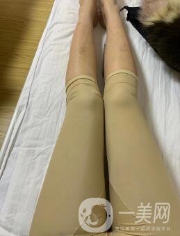 福建省立醫(yī)院整形科價格(目)表2020，附大小腿吸脂案例