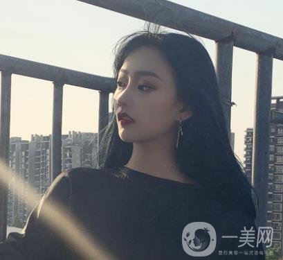 北京醫(yī)院趙紅藝做鼻子多少錢?價(jià)格表和真人*果變化圖一覽