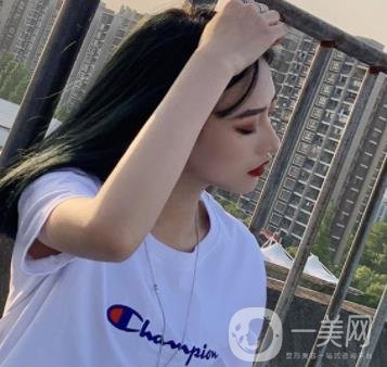 北京醫(yī)院趙紅藝做鼻子多少錢?價(jià)格表和真人*果變化圖一覽