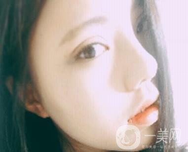 西安唐都醫(yī)院價格表價目表，內附吳瓊隆鼻整形日記