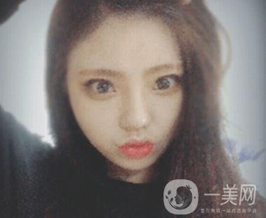 西安唐都醫(yī)院價格表價目表，內附吳瓊隆鼻整形日記