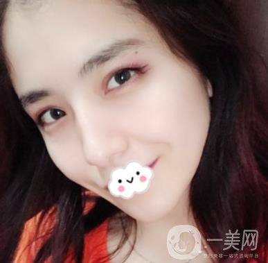 上海伯思立整形怎么樣？附沈國雄隆鼻案例及整形價(jià)格表