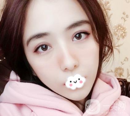 上海伯思立整形怎么樣？附沈國雄隆鼻案例及整形價(jià)格表