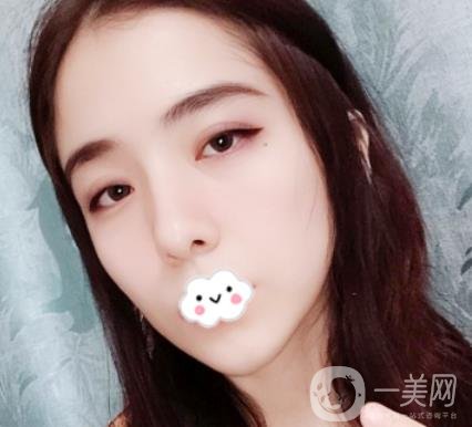 上海伯思立整形怎么樣？附沈國雄隆鼻案例及整形價(jià)格表