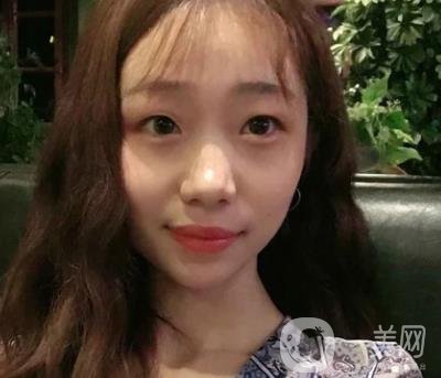 上海華美李志海磨骨多少錢？案例有嗎？整形價格表一覽