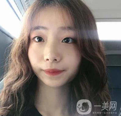 上海華美李志海磨骨多少錢？案例有嗎？整形價格表一覽