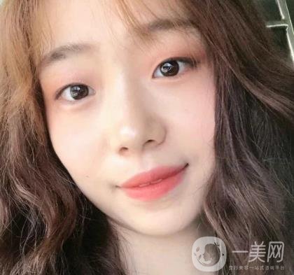 上海華美李志海磨骨多少錢？案例有嗎？整形價格表一覽