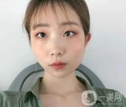 上海華美李志海磨骨多少錢？案例有嗎？整形價格表一覽