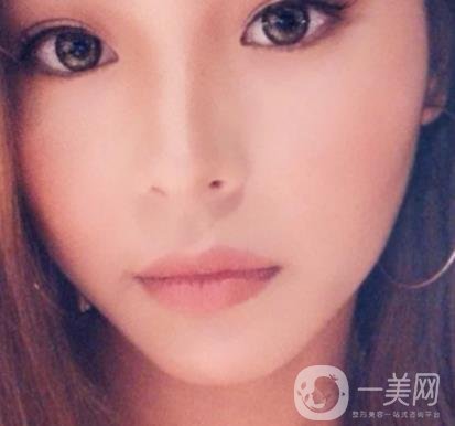 上海九院切下頜角手術經歷分享，附2020整形價格一覽表