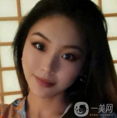 上海九院切下頜角手術經歷分享，附2020整形價格一覽表