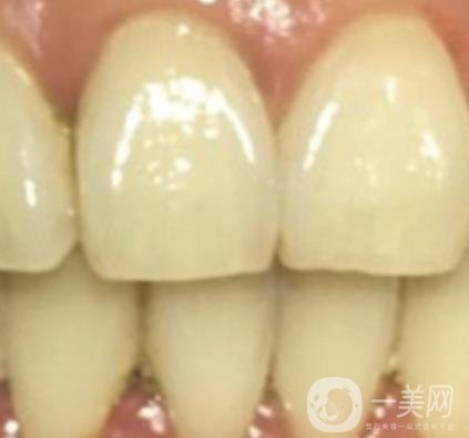 滿莊鎮(zhèn)衛(wèi)生院整牙