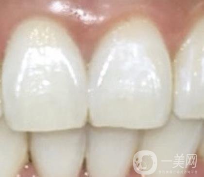 滿莊鎮(zhèn)衛(wèi)生院整牙