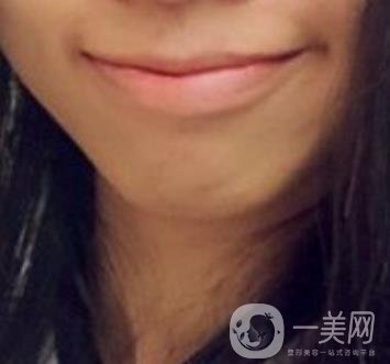 長征醫(yī)院 整牙