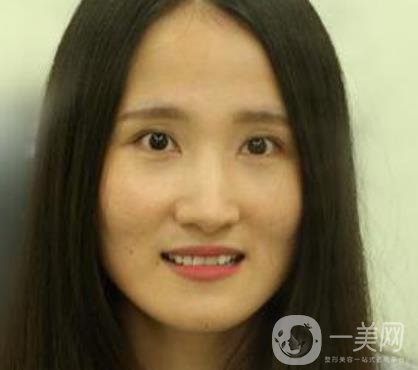 北京市海淀醫(yī)院整牙多少錢？看價(jià)格表及案例*果