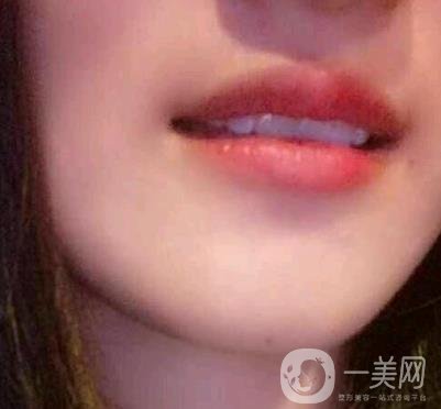 北京市海淀醫(yī)院整牙多少錢？看價(jià)格表及案例*果