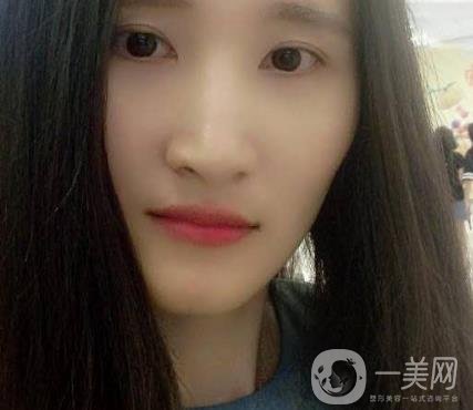 北京市海淀醫(yī)院整牙多少錢？看價(jià)格表及案例*果