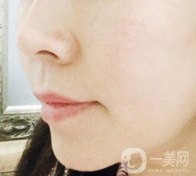 蘭州軍區(qū)陸軍總院皮膚科價(jià)格表_祛痣案例展示