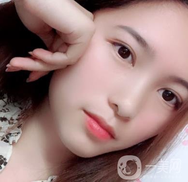 沈陽軍區(qū)總醫(yī)院整形外科價(jià)格表2020，附雙眼皮案例