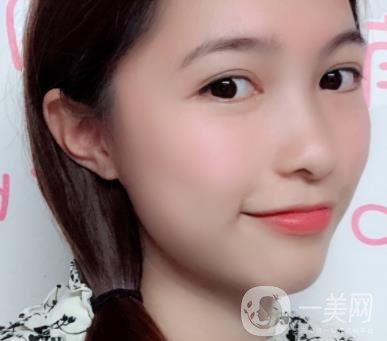 沈陽軍區(qū)總醫(yī)院整形外科價(jià)格表2020，附雙眼皮案例