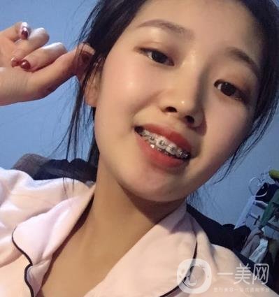 301醫(yī)院整牙