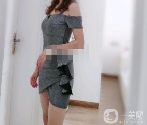 安陽地區(qū)醫(yī)院抽脂