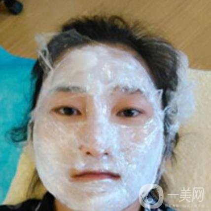 龍崗中心醫(yī)院整形外科價格表（收費）,附去斑案例詳情