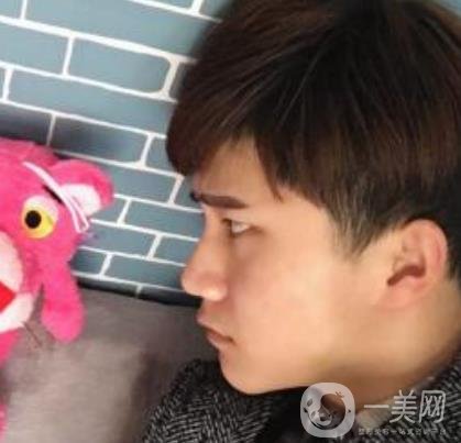 棗莊市立醫(yī)院燒傷整形美容科做光子嫩膚好嗎？價格表及術(shù)后*果分享