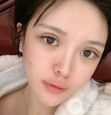 石家莊市醫(yī)院整形美容外科價(jià)格表2020，附雙眼皮實(shí)例