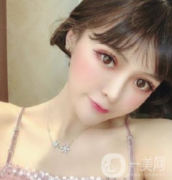 石家莊市醫(yī)院整形美容外科價(jià)格表2020，附雙眼皮實(shí)例