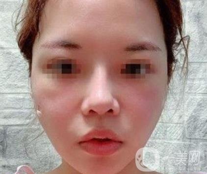 四川省人民醫(yī)院整形外科游曉波磨骨怎么樣?價格收費明細表一覽