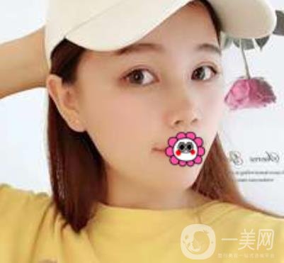 河南省人民醫(yī)院誰做雙眼皮好？附案例及2020整形價(jià)格表