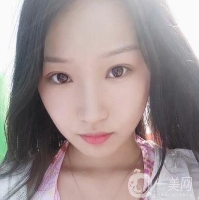 北大醫(yī)院美容價格表，附自體脂肪填充面部前后照