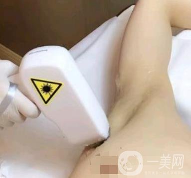 廈門中醫(yī)院陳華脫毛靠譜嗎？?jī)r(jià)格表及案例*果一覽