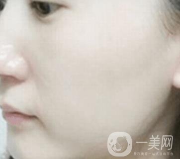 南通大學(xué)附屬醫(yī)院整形科價(jià)格表，附激光去疤案例