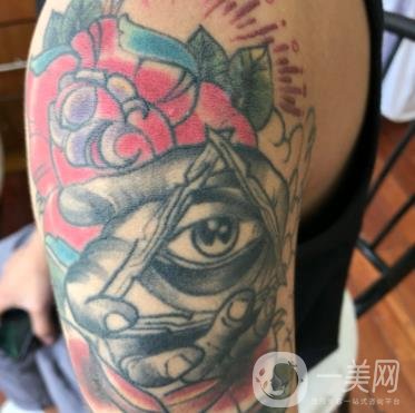 徐州市中心醫(yī)院整形科價(jià)格表，附洗紋身案例