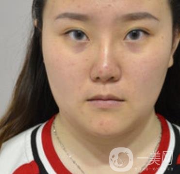 杭州市第三醫(yī)院整形價(jià)格表及*案例一覽