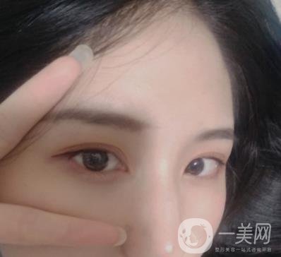 布仁醫(yī)生隆鼻