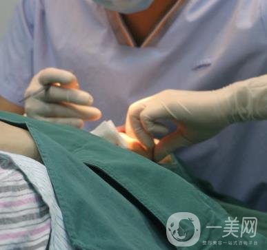 上海時(shí)光醫(yī)院何晉龍磨骨怎么樣？價(jià)格表及術(shù)后*果分享