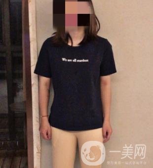 中南大學第一醫(yī)院整形美容科價格表*新發(fā)布,附全身吸脂*果分享