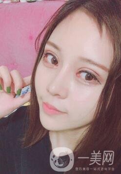 蘭大二院整形外科價格表2020，附雙眼皮整形日記